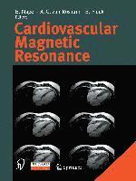 Cardiovascular Magnetic Resonance 1