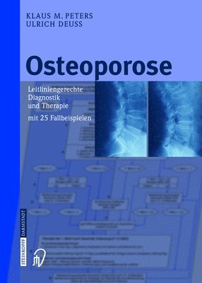 bokomslag Osteoporose