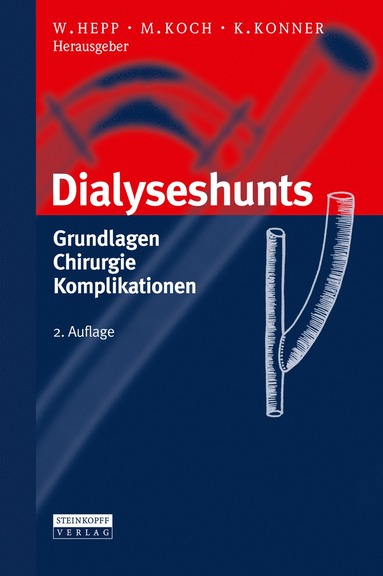 bokomslag Dialyseshunts