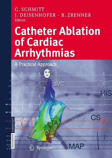 C. Schmitt, I. Deisenhofer, B. Zrenner - Catheter Ablation of Cardiac Arrhythmias, Inbunden