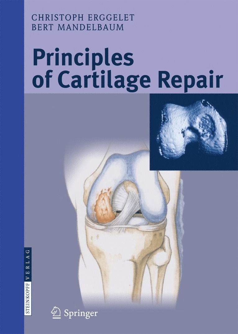 Christoph Erggelet, Bert R. Mandelbaum - Principles of Cartilage Repair, Inbunden