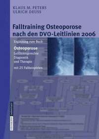 bokomslag Falltraining Osteoporose nach den DVO-Leitlinien 2006