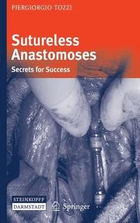 bokomslag Sutureless Anastomoses