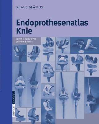 Klaus Bläsius - Endoprothesenatlas Knie, Häftad