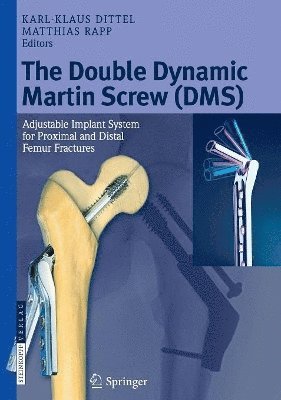 Karl-Klaus Dittel, Matthias Rapp - Double Dynamic Martin Screw (DMS), Inbunden