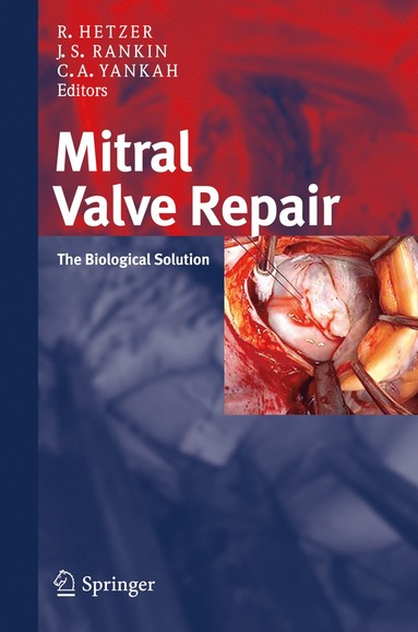 bokomslag Mitral Valve Repair