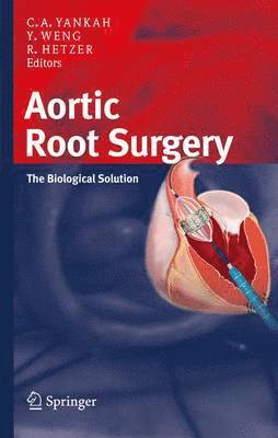 Charles Abraham Yankah, Yu-Guo Weng, Roland Hetzer - Aortic Root Surgery, Inbunden