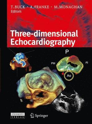 bokomslag 3D-Echocardiography