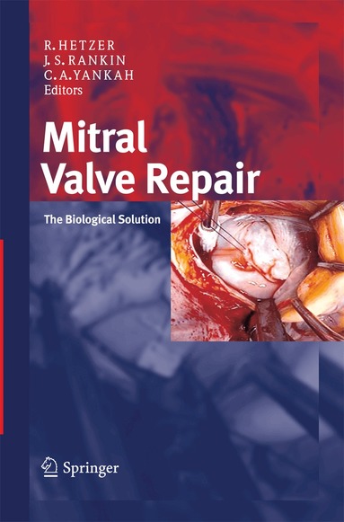 Roland Hetzer, J. Scott Rankin, Charles Abraham Yankah - Mitral Valve Repair, Häftad
