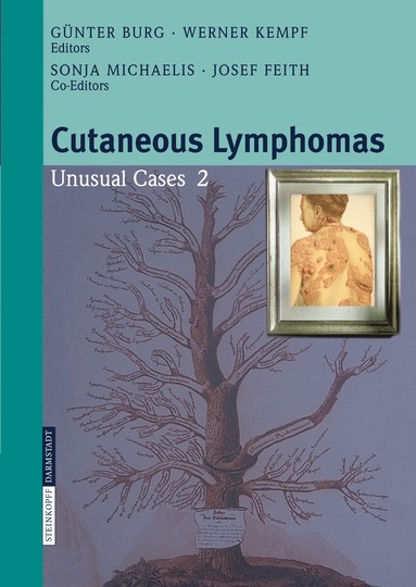 bokomslag Cutaneous Lymphomas