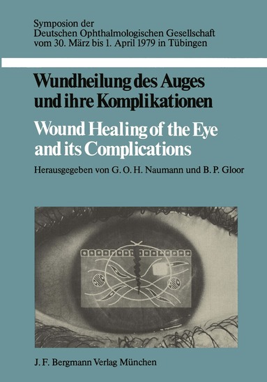 G.O.H. Naumann, B.P. Gloor - Wundheilung des Auges und ihre Komplikationen / Wound Healing of the Eye and its Complications, Häftad