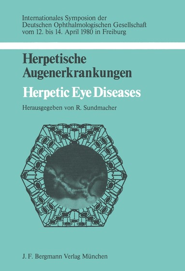 R. Sundmacher - Herpetische Augenerkrankungen, Häftad