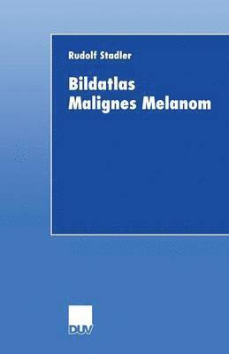 Bildatlas Malignes Melanom 1