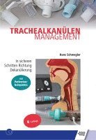 bokomslag Trachealkanülenmanagement