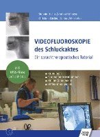 bokomslag Videofluoroskopie des Schluckaktes