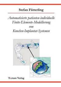 bokomslag Automatisierte patienten-individuelle Finite-Elemente-Modellierung von Knochen-Implantat-Systemen