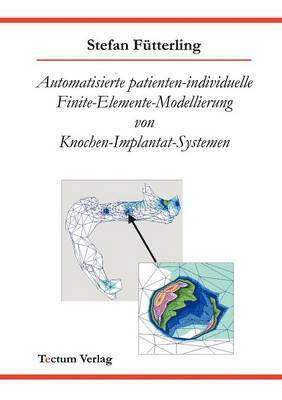 Automatisierte patienten-individuelle Finite-Elemente-Modellierung von Knochen-Implantat-Systemen 1