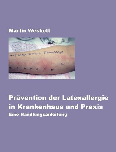bokomslag Prävention der Latexallergie in Krankenhaus und Praxis