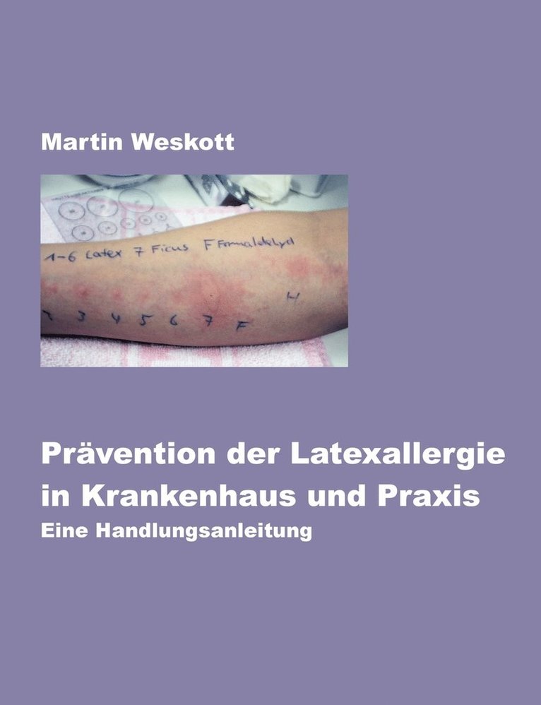 Prvention der Latexallergie in Krankenhaus und Praxis 1