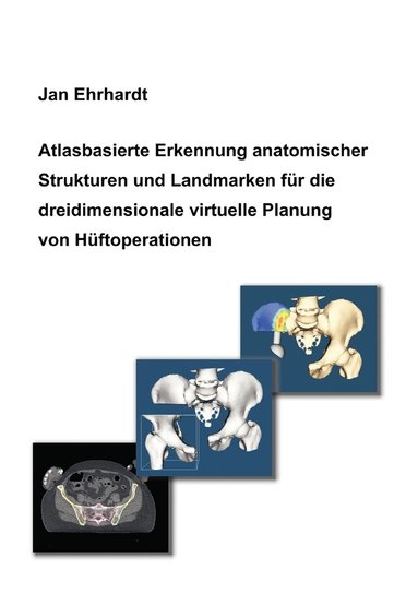 bokomslag Atlasbasierte Erkennung anatomischer Strukturen und Landmarken für die dreidimensionale virtuelle Planung von Hüftoperationen