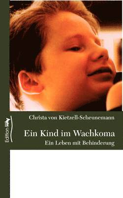 bokomslag Kind im Wachkoma