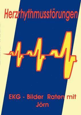 bokomslag Herzrhythmusstörungen