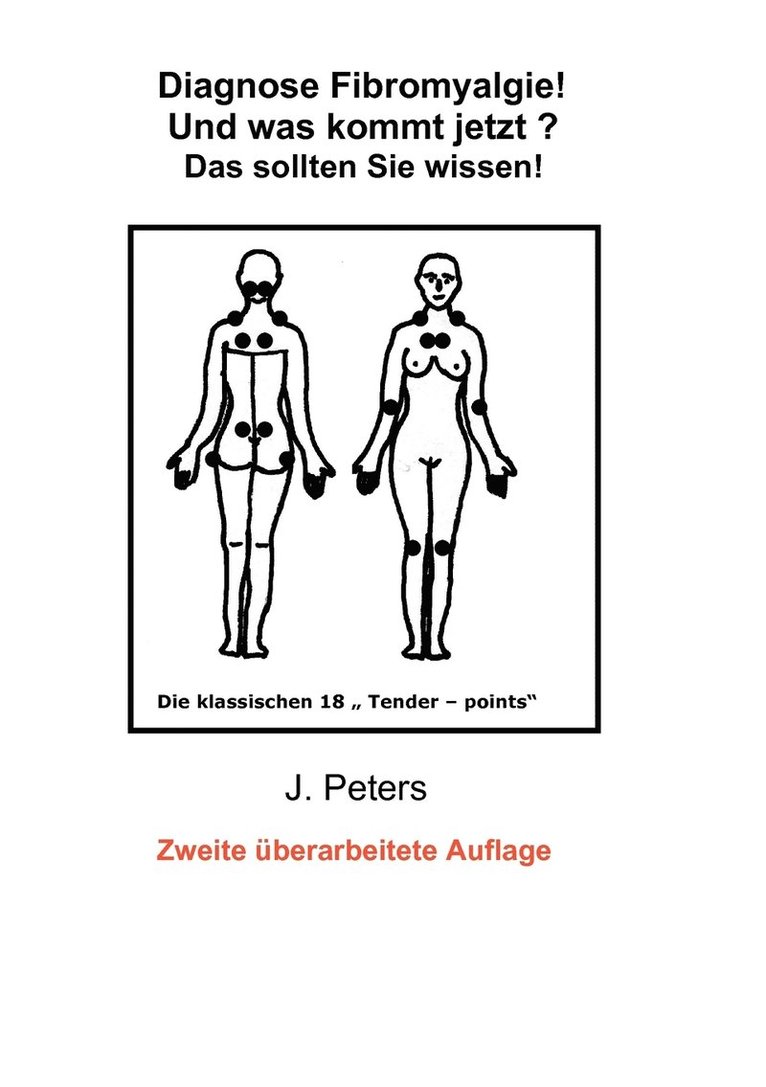 Diagnose Fibromyalgie! Und was kommt jetzt? 1