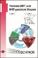 bokomslag Prostata-MRT und MRT-gestützte Biopsie