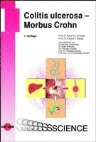 bokomslag Colitis ulcerosa - Morbus Crohn