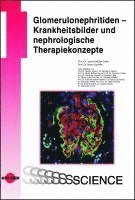 bokomslag Glomerulonephritiden - Krankheitsbilder und nephrologische Therapiekonzepte