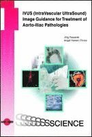 bokomslag IVUS (IntraVascular UltraSound) Image Guidance for Treatment of Aorto-Iliac Pathologies