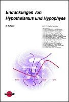 bokomslag Erkrankungen von Hypothalamus und Hypophyse