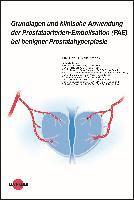 bokomslag Grundlagen und klinische Anwendung der Prostataarterien-Embolisation (PAE) bei benigner Prostatahyperplasie