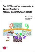 bokomslag Das HER2-positive metastasierte Mammakarzinom - Aktuelle Behandlungskonzepte