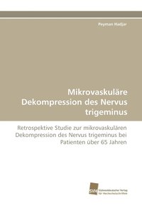 bokomslag Mikrovaskulre Dekompression des Nervus trigeminus