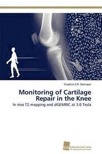 bokomslag Monitoring of Cartilage Repair in the Knee