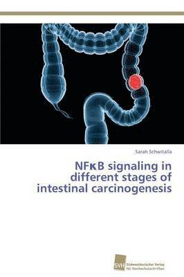 NF&#954;B signaling in different stages of intestinal carcinogenesis 1