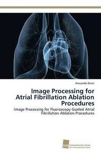 bokomslag Image Processing for Atrial Fibrillation Ablation Procedures