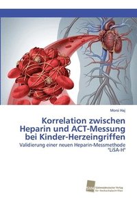 bokomslag Korrelation zwischen Heparin und ACT-Messung bei Kinder-Herzeingriffen