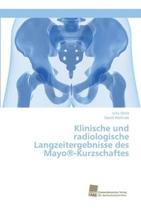 bokomslag Klinische und radiologische Langzeitergebnisse des Mayo(R)-Kurzschaftes