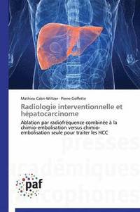 bokomslag Radiologie Interventionnelle Et Hepatocarcinome