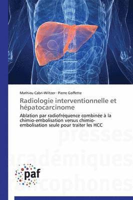 bokomslag Radiologie Interventionnelle Et Hépatocarcinome
