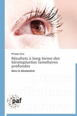 bokomslag Résultats À Long Terme Des Kératoplasties Lamellaires Profondes