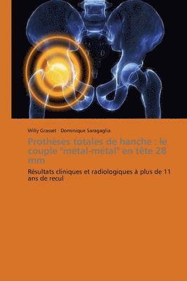 Protheses Totales de Hanche 1