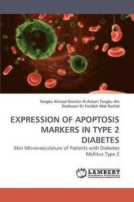 Expression of Apoptosis Markers in Type 2 Diabetes 1