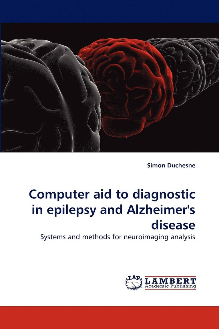 Computer aid to diagnostic in &#8232;epilepsy and &#8232;Alzheimer's disease 1