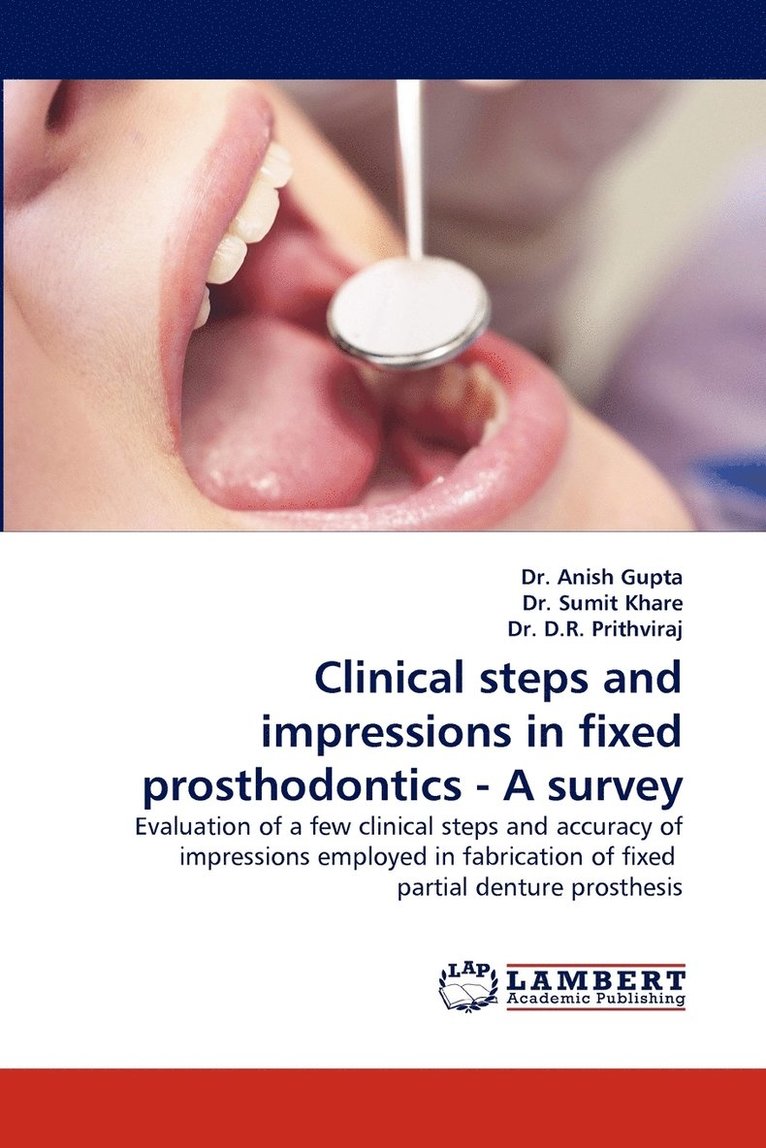Clinical Steps and Impressions in Fixed Prosthodontics - A Survey 1