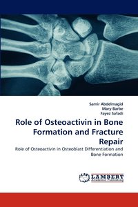 bokomslag Role of Osteoactivin in Bone Formation and Fracture Repair
