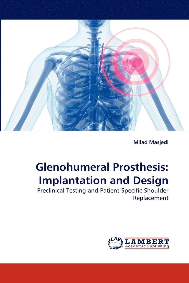 Glenohumeral Prosthesis 1