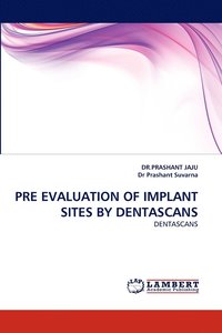 bokomslag Pre Evaluation of Implant Sites by Dentascans
